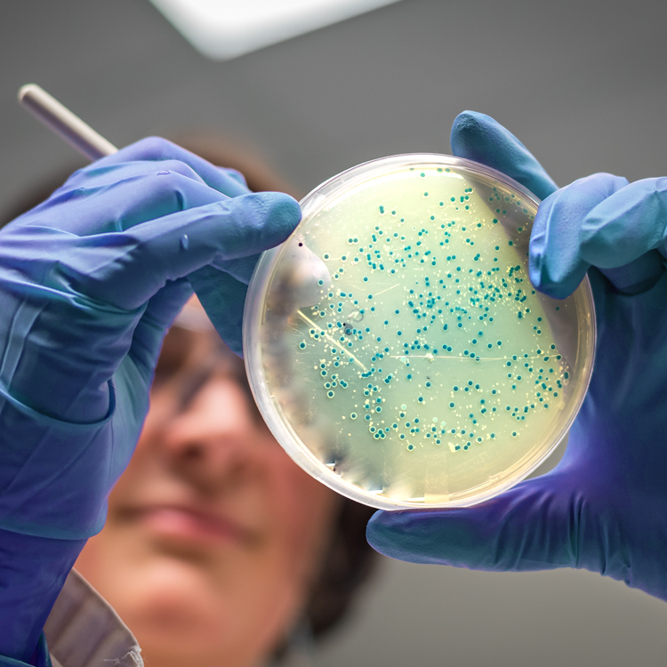 Resistencia antimicrobiana